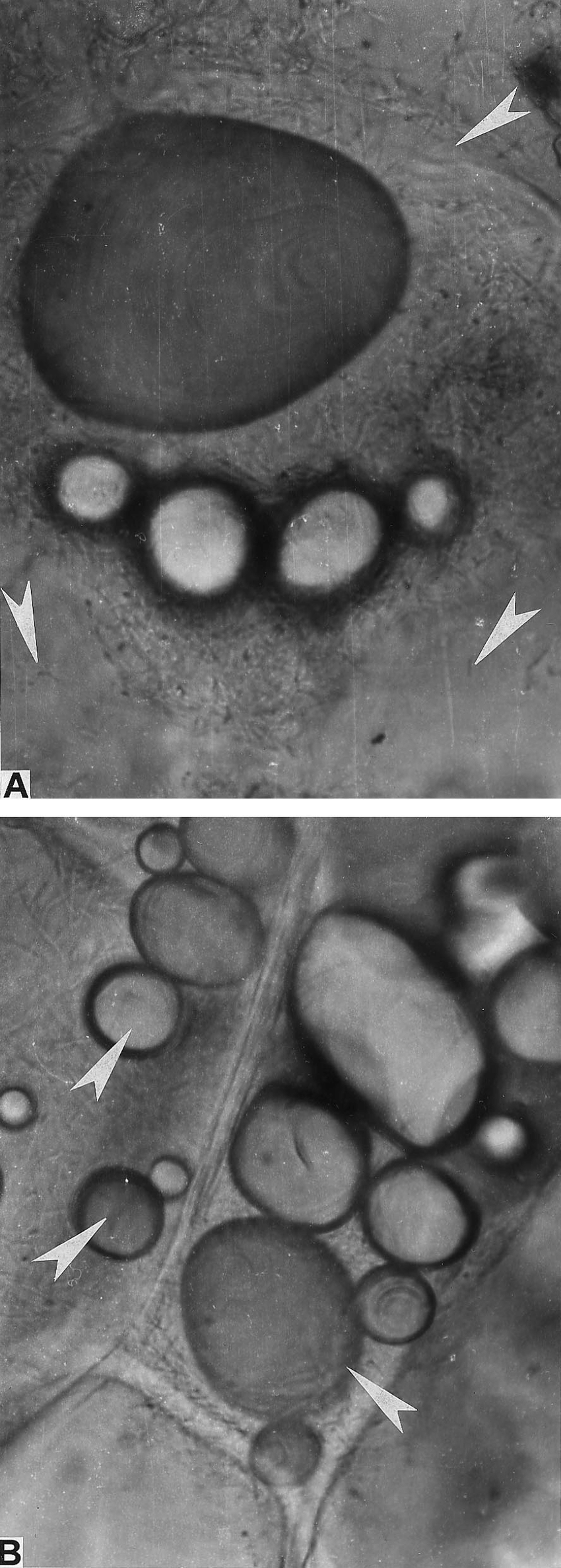 Erwinia carotovora-potato cell interaction. (A) Tissue maceration and cell collapse caused by Erwinia carotovora subsp. carotovora 8982 inoculated at 10 8 cfu/mL. (B) A potato tuber slice treated with concentrated filtrate of a 4-day-old culture of Bacillus subtilis BS 107 prior to inoculation. Arrows indicate the cell wall remnants, neighbouring cells, and groups of starch grains. Magnification, 400×. 