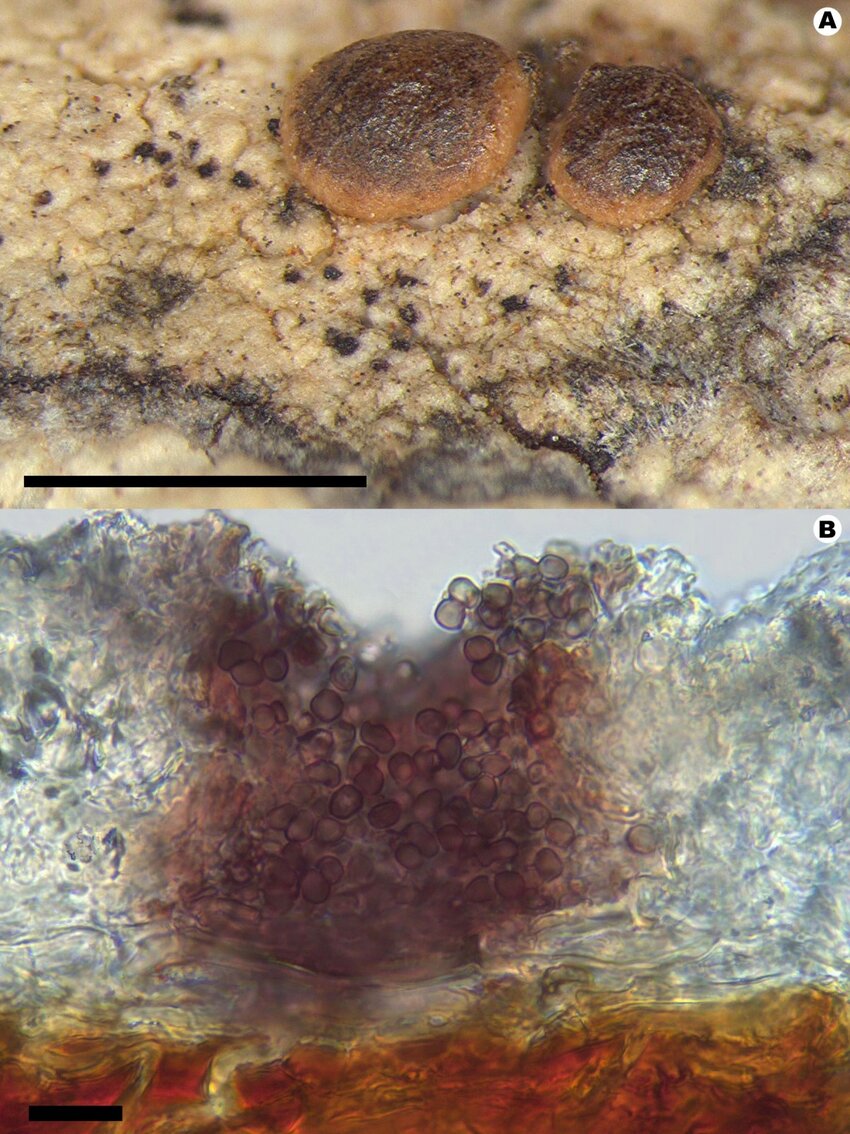 , holotype of Isthmoconidium bacidiicola. A, habit of the fungus illustrating the black sporodochia on the thallus of the host, Bacidia heterochroa (scale = 0.5 mm). B, vertical section through a partially immersed sporodochium where the uppermost portion has been eroded (scale = 10 µm).  