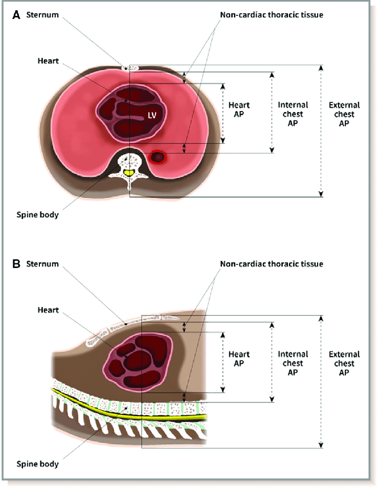 Image Of Chest Anatomy And Measurements For Chest Parameters A Axial Download Scientific Diagram