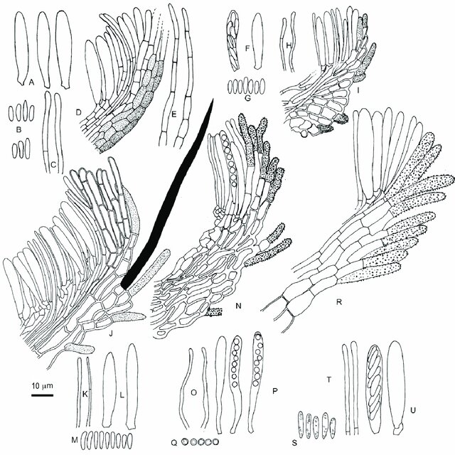 Diagrammatic Representation Of The Sexual Morphs In Hyphodiscaceae Download Scientific Diagram