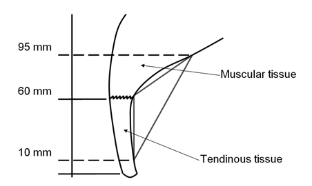 Scheme of the length of the tendinous tissue in the internal oblique muscle. 