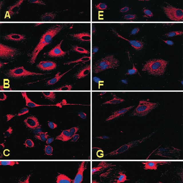 Immunoreactive ET1 protein expression by confocal microscopy of HUVEC