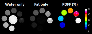 Water and fat images and PDFF maps of fat–water emulsions with different fat fractions (0%, 10%, 20%, 30%, 40%, 50%, and 60%, starting from bottom left). Consistent fat–water separation in each tube is shown.