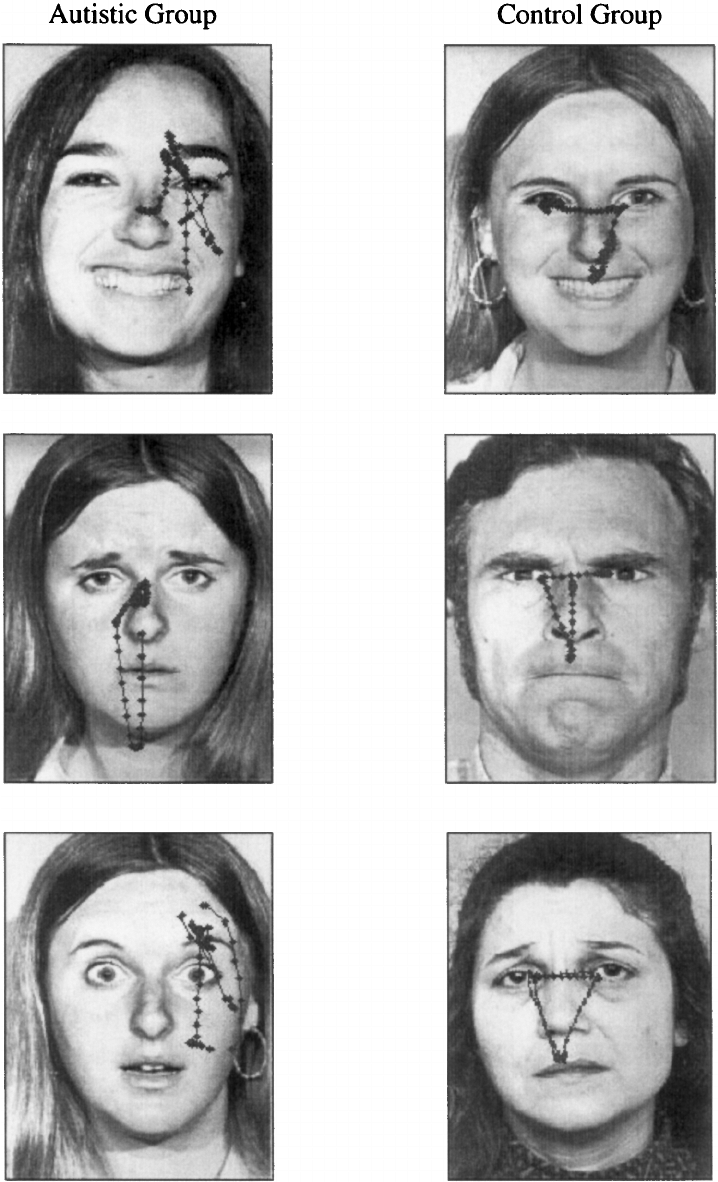 Sample scanpaths from phase I of the experiment for three autistic participants (first column) and three control participants (second column). Participants were instructed to examine the faces in any manner they selected. 