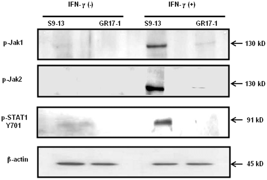 Western Blot Analysis Showing Low Level P Jak1 And P Jak 2 Expression Download Scientific 4846