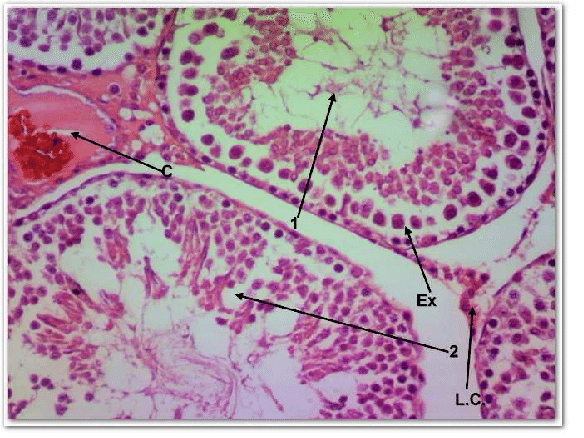 transverse sections in rat testis from the two weeks AlCl 3 intoxicated ...