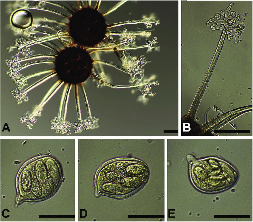 Erysiphe blasti on Lindera umbellata (TSU-MUMH 4568). A: Chasmothecia. B: Appendage. CeE: Asci and ascospores. Bars: 50 mm. 