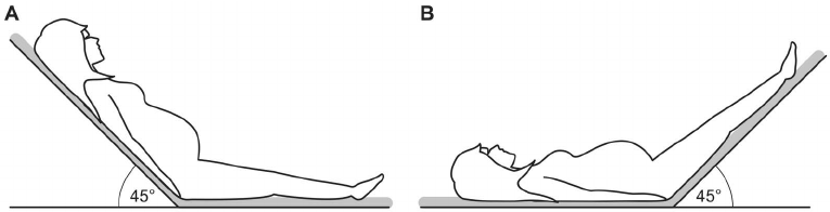 semi recumbent position