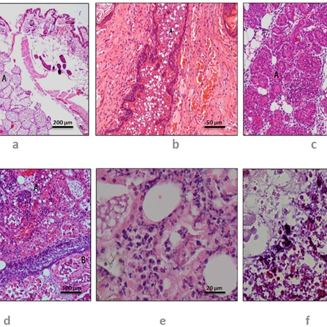 Histopathological Changes Observed In Mouse Mammary Tissue Control Download Scientific Diagram