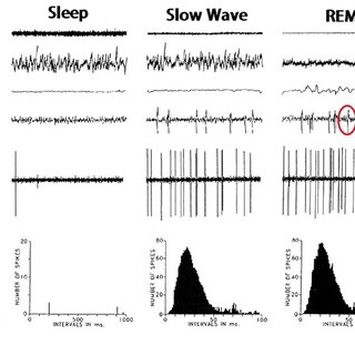 Human Invasive Recordings Pgo Like Waves Recorded From The Download Scientific Diagram