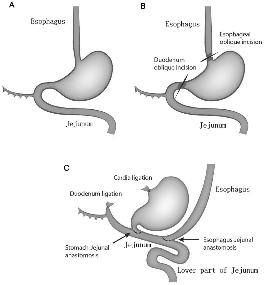 esophagus and stomach