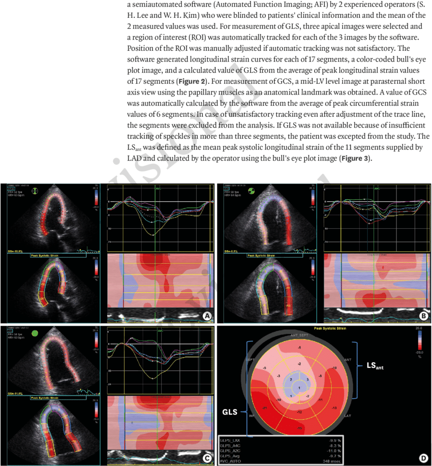 Two-dimensional Echocardiographic Assessment of Myocardial Strain