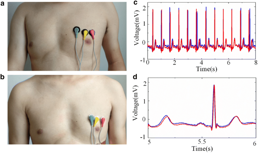 Electrostimulation electrode gel - Telic - for monitoring / ECG