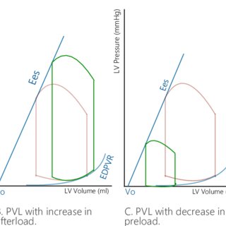 Various interventions on the PVL loop. A. LV PVL at rest; B. Increase ...