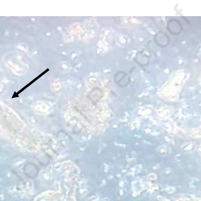 Urine Microscopy Wbc Cast Download Scientific Diagram 0684