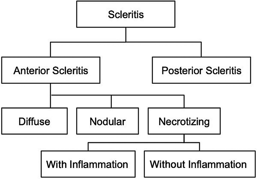 episcleritis vs scleritis