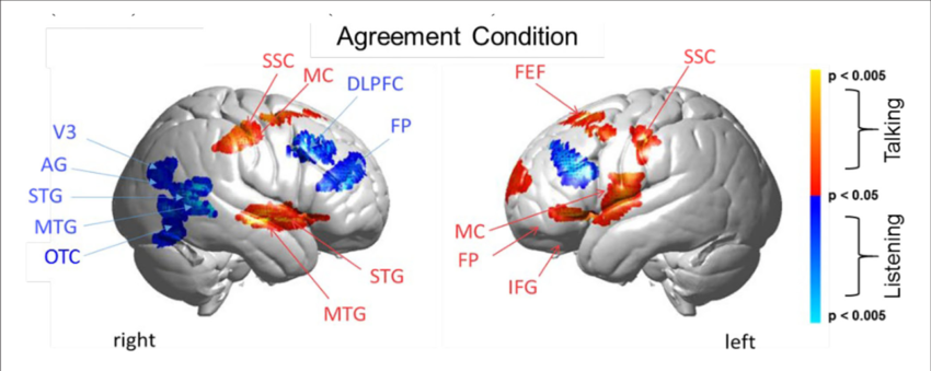 STG, superior temporal gyrus; IFG, inferior frontal cortex; FEF