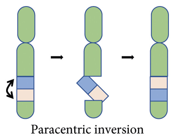 Chromosomal inversions: two breaks in the same chromosome, causing the resulting fragments to reconnect after 180 degrees of reversal. (a) Paracentric inversion: the inverted segments do not contain chromosomes. (b) Pericentric inversion: the inverted segments contain chromosomes. (c) Possible gametes of paracentric inversion. In meiosis, a crossover between a normal chromosome and an inverted chromosome results in the loss or duplication of a segment of the gametophyte chromosome, leading to chromosome abnormality and abnormal traits in the offspring. Balanced gametes are designated by the green border. Unbalanced gametes are designated by the red border. (d) Possible gametes of pericentric inversion. Balanced gametes are designated by the green border. Unbalanced gametes are designated by the red border.