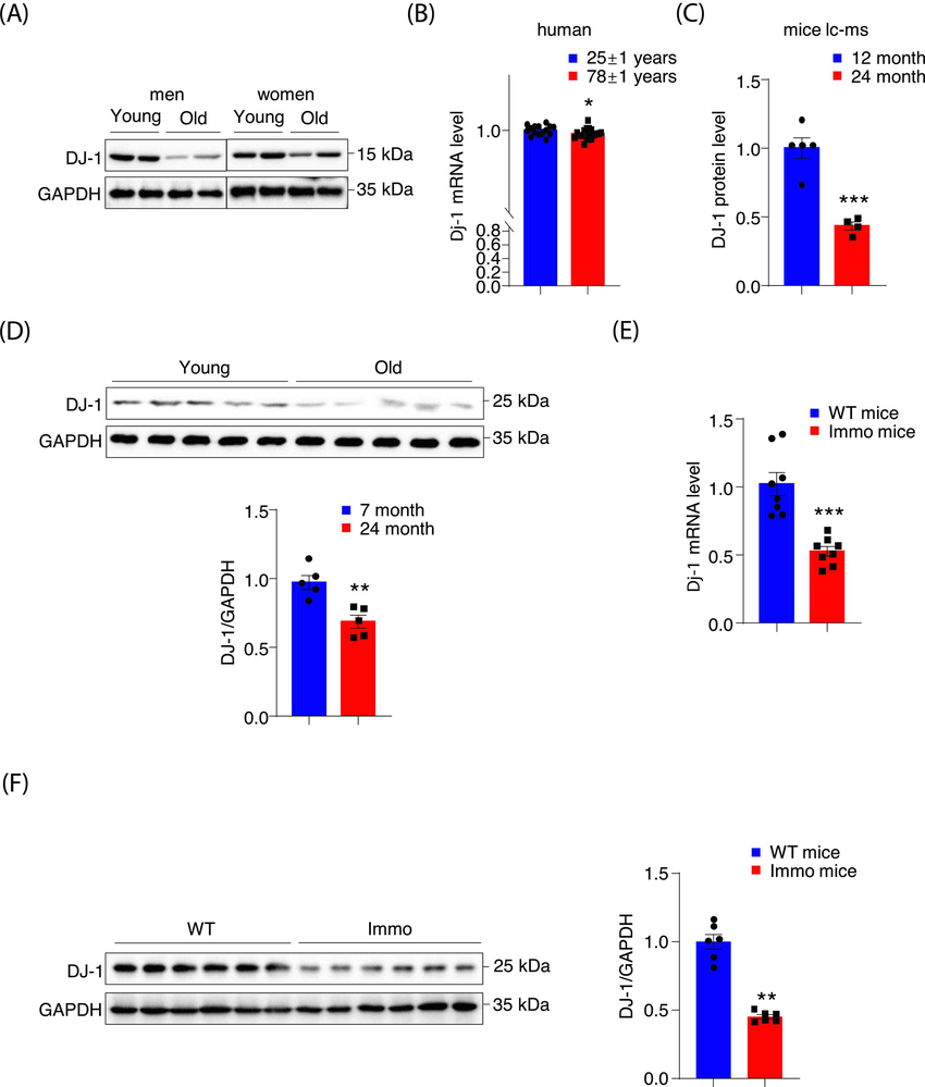 DJ‐1 expression is decreased in skeletal muscle from human and mice ...