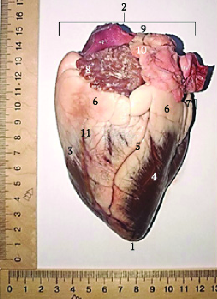 Researchers reveal impact of obesity on the heart's anatomy for