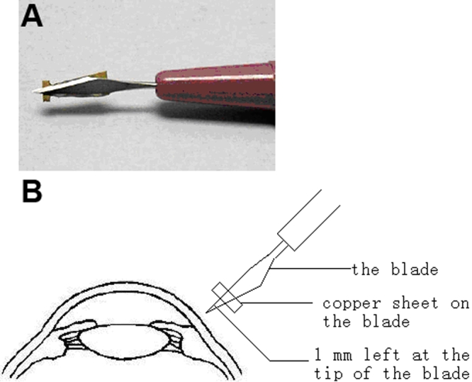 The Method For Preparation Of A 1 Mm-Depth Penetrating Ocular.