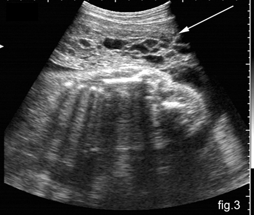 30 weeks pregnant ultrasound